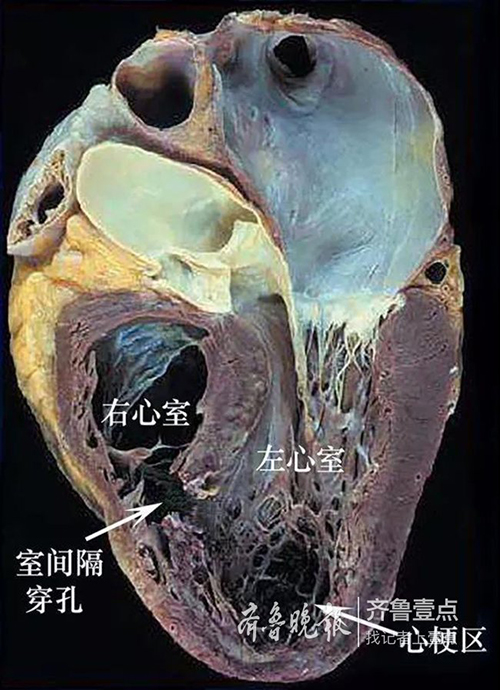 微信图片_20190202091124.jpg 微信图片_20190202091124.jpg