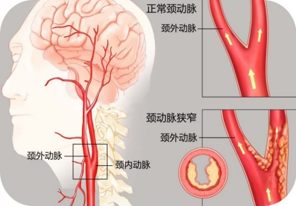 图片 1.jpg