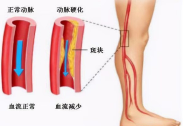 图片 1.jpg