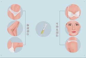 图片 2.jpg