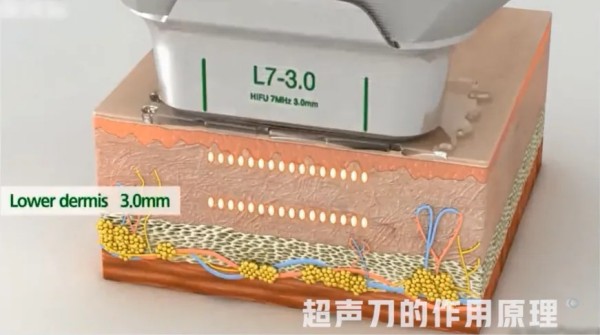 图片 2.jpg
