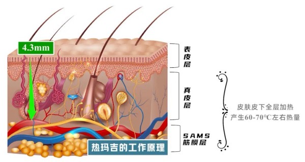 图片 3.jpg