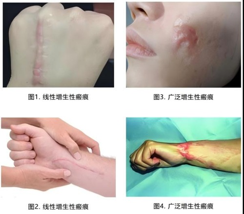 图片 1.jpg