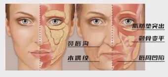 图片 3.jpg