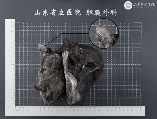 香港奖现场直播结果